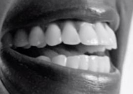 Picture of Issa Rae teeth and smile