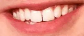 Picture of Jacob Elordi teeth and smile