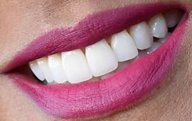 Picture of Jada Pinkett Smith teeth and smile