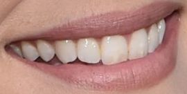 Picture of Jaimie Alexander teeth