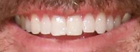 Picture of Jake Owen teeth and smile