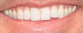 Picture of Jake Owen teeth and smile