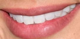Picture of Jamie Chung teeth and smile