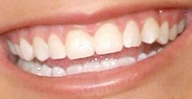Picture of Jamie Lynn Spears teeth and smile