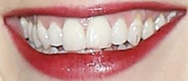 Picture of Jane Levy teeth and smile