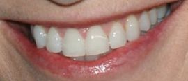Picture of Jane Lynch teeth and smile