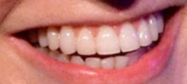 Picture of Jane Lynch teeth and smile