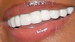 Picture of Janelle Monae teeth and smile