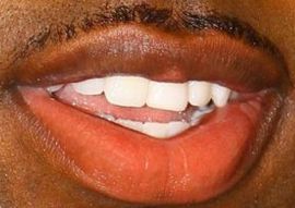 Picture of Jason Derulo teeth and smile