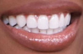 Picture of Javicia Leslie teeth and smile