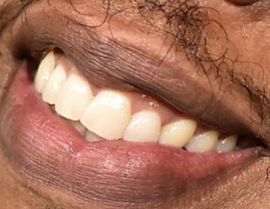 Picture of Jay-Z teeth and smile