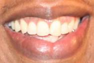 Picture of Jay-Z teeth and smile