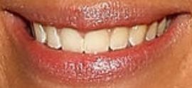 Picture of Jenna Compono teeth and smile