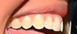 Picture of Jenna Compono teeth and smile