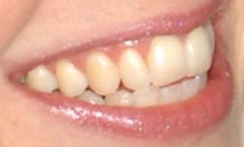 Picture of Jenna Fischer teeth and smile