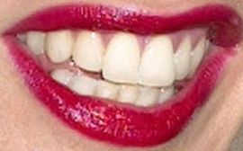 Picture of Jennifer Connelly teeth and smile