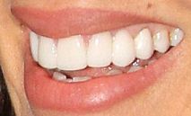 Picture of Jennifer Esposito teeth and smile