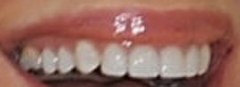 Picture of Jennifer Gareis teeth and smile