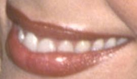 Picture of Jennifer Gareis teeth and smile