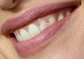 Picture of Jennifer Garner teeth and smile