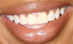 Picture of Jennifer Hudson's teeth and smile while smiling