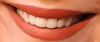 Picture of Jennifer Lawrence's teeth and smile