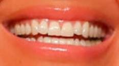 Jennifer Lopez's teeth and smile