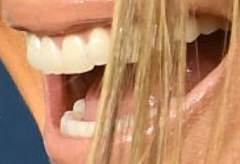 Jennifer Lopez 's teeth and smile