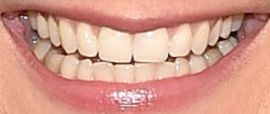 Picture of Jennifer Nettles teeth and smile