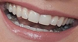 Picture of Jennifer Nettles teeth and smile