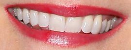 Picture of Jennifer Robertson teeth and smile