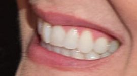 Picture of Jennifer Robertson teeth and smile