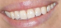 Jessica Biel teeth