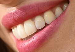 Jessica Biel teeth