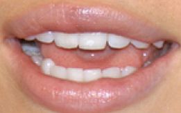 Picture of Jessica Biel's teeth and smile