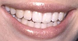 Picture of Jessica Biel's teeth and smile