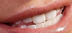Jessica Simpson's teeth