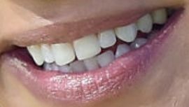Picture of Jessica Szohr teeth and smile