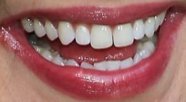 Picture of Jessica Szohr teeth and smile