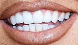 Picture of Jesy Nelson teeth and smile