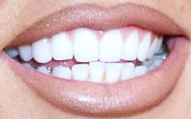 Picture of Jesy Nelson teeth and smile