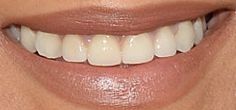 Picture of Jhene Aiko teeth and smile