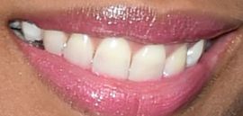 Picture of Jhene Aiko teeth and smile