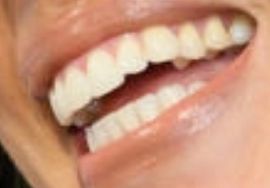 Picture of Joanna Gaines teeth and smile