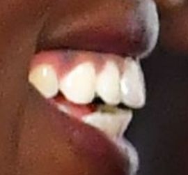 Picture of Jodie Turner-Smith teeth and smile