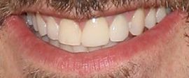 Picture of Joey Fatone teeth and smile