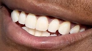 John Boyega's teeth
