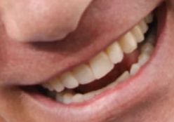 John Cena teeth