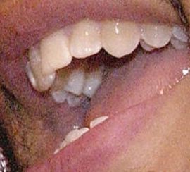 Picture of John Legend teeth and smile