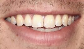 Picture of John Mulaney teeth and smile